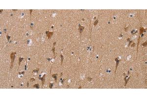 Immunohistochemistry of paraffin-embedded Human brain using POMT1 Polyclonal Antibody at dilution of 1:50 (POMT1 Antikörper)