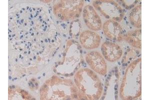 Immunohistochemistry (IHC) image for anti-C-Ros Oncogene 1 , Receptor tyrosine Kinase (ROS1) (AA 1945-2222) antibody (ABIN7442438)