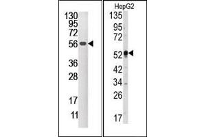 Image no. 1 for anti-Dual Specificity Phosphatase 4 (DUSP4) (C-Term) antibody (ABIN360778) (DUSP4 Antikörper  (C-Term))