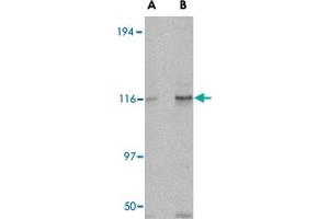 Western blot analysis of KIF5A in K-562 cell lysate with KIF5A polyclonal antibody  at (A) 0. (KIF5A Antikörper  (C-Term))