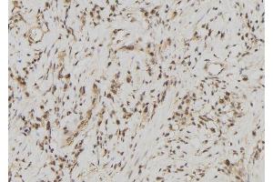 ABIN6278171 at 1/100 staining Human gastric tissue by IHC-P. (FDPS Antikörper  (Internal Region))
