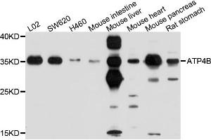 Western blot analysis of extracts of various cell lines, using ATP4B antibody (ABIN4902983) at 1:1000 dilution. (ATP4b Antikörper)