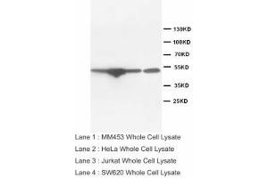Image no. 2 for anti-Endothelin Receptor Type B (EDNRB) (Internal Region) antibody (ABIN1490394) (EDNRB Antikörper  (Internal Region))