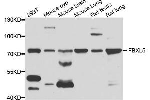 Western blot analysis of extracts of various cell lines, using FBXL5 antibody (ABIN1876803) at 1:1000 dilution. (FBXL5 Antikörper)