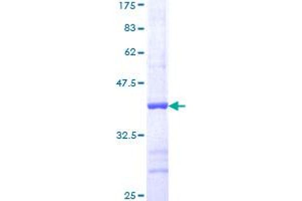 MEK1 Protein (AA 294-393) (GST tag)