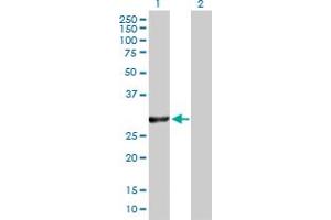 Western Blot analysis of VAPB expression in transfected 293T cell line by VAPB MaxPab polyclonal antibody. (VAPB Antikörper  (AA 1-243))