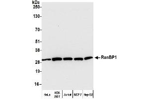 Western Blotting (WB) image for anti-RAN Binding Protein 1 (RANBP1) (AA 1-50) antibody (ABIN7454641)