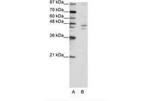 Image no. 1 for anti-Zinc Finger Protein 419 (ZNF419) (C-Term) antibody (ABIN202693) (ZNF419 Antikörper  (C-Term))