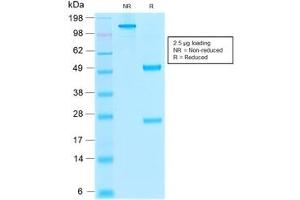 SDS-PAGE analysis of purified, BSA-free recombinant Thrombomodulin antibody (clone rTHBD/1591) as confirmation of integrity and purity. (Thrombomodulin Antikörper  (AA 69-194))