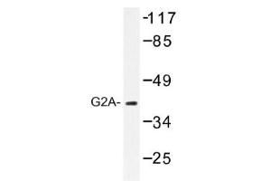 Image no. 1 for anti-G Protein-Coupled Receptor 132 (GPR132) antibody (ABIN317643) (G Protein-Coupled Receptor 132 Antikörper)