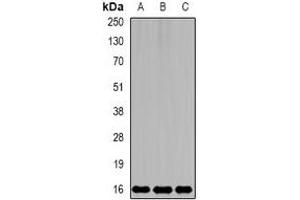 Western blot analysis of MsrB2 expression in mouse kidney (A), mouse brain (B), rat liver (C) whole cell lysates.