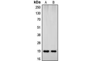 Western blot analysis of Beta-synuclein expression in HeLa (A), human brain (B) whole cell lysates. (beta Synuclein Antikörper  (C-Term))