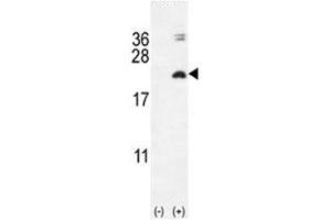 Western blot analysis of IL17F antibody and 293 cell lysate (2 ug/lane) either nontransfected (Lane 1) or transiently transfected with the IL17F gene (2). (IL17F Antikörper  (AA 16-45))