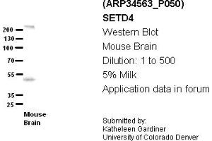 Image no. 2 for anti-SET Domain Containing 4 (SETD4) (C-Term) antibody (ABIN404949) (SETD4 Antikörper  (C-Term))