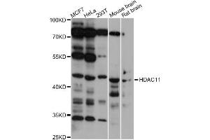 Western blot analysis of extracts of various cell lines, using HDAC11 antibody (ABIN5975404) at 1/1000 dilution. (HDAC11 Antikörper)