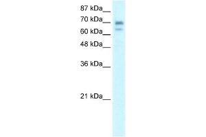 WB Suggested Anti-HR Antibody Titration:  0.