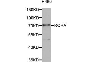 Western blot analysis of extracts of H460 cells, using RORA antibody (ABIN5974193) at 1/1000 dilution. (RORA Antikörper)