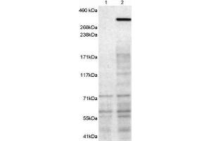 ABIN2564100 (1µg/ml) staining of 1) untransfected HEK293T cells 2) HEK293T cells transfected with mouse NBEA. (Neurobeachin Antikörper  (C-Term))