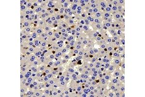 Immunohistochemistry of paraffin embedded mouse liver using IL-2 Receptor alpha (ABIN7074349) at dilution of 1: 200 (400x lens) (CD25 Antikörper)