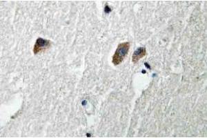 Immunohistochemistry (IHC) analyzes of CaMKIIbeta/gamma/delta antibody in paraffin-embedded human brain tissue. (CAMK2B Antikörper)