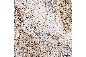 IHC analysis of SNF2H/SMARCA5 using anti-SNF2H/SMARCA5 antibody (ABIN7602001).