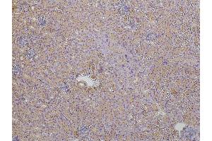 Immunohistochemistry (IHC) image for anti-Tight Junction Protein 1 (TJP1) (C-Term) antibody (ABIN6254231)