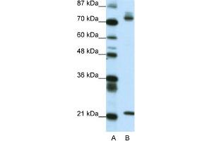 WB Suggested Anti-SATB1 Antibody Titration: 0. (SATB1 Antikörper  (C-Term))