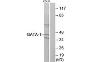 Western blot analysis of extracts from COLO cells, using GATA1 (Ab-142) Antibody.