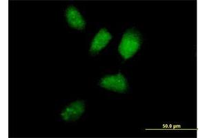 Immunofluorescence of purified MaxPab antibody to RNF8 on HeLa cell. (RNF8 Antikörper  (AA 1-485))