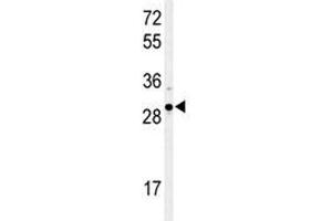 Western Blotting (WB) image for anti-X-Box Binding Protein 1 (XBP1) (AA 62-91) antibody (ABIN3029642)