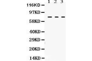 Anti- TGM2 Picoband antibody, Western blotting All lanes: Anti TGM2  at 0. (Transglutaminase 2 Antikörper  (N-Term))