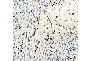 IHC analysis of Survivin/Calcitonin/CALCA using anti-Survivin/Calcitonin/CALCA antibody (ABIN4886497). (CGRP Antikörper  (C-Term))