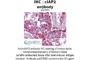 Image no. 2 for anti-Baculoviral IAP Repeat Containing 3 (BIRC3) (AA 314-508) antibody (ABIN1733088) (BIRC3 Antikörper  (AA 314-508))