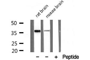 Western blot analysis of extracts of various tissue sample,using PDLIM1 Antibody . (PDLIM1 Antikörper  (Internal Region))