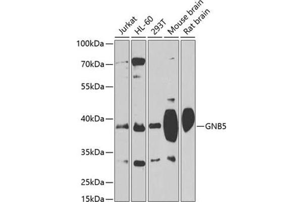 GNB5 Antikörper  (AA 1-200)