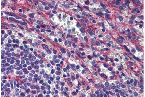 Human Spleen: Formalin-Fixed, Paraffin-Embedded (FFPE) (PLIN3 Antikörper  (AA 1-435))