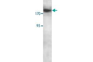 Western blot analysis of Jurkat cell lysate with RBBP6 polyclonal antibody  at 1 : 250 dilution. (RBBP6 Antikörper  (C-Term))