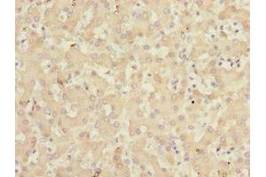 Immunohistochemistry of paraffin-embedded human liver tissue using ABIN7157720 at dilution of 1:100 (KLF15 Antikörper  (AA 1-260))