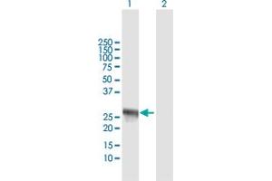 Western Blot analysis of IFIH1 expression in transfected 293T cell line by IFIH1 MaxPab polyclonal antibody. (IFIH1 Antikörper  (AA 1-221))
