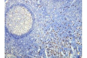 Immunohistochemistry (IHC) image for anti-lambda Light Chain (Lambda-IgLC) (AA 50-68), (N-Term) antibody (ABIN870374) (Lambda-IgLC Antikörper  (N-Term))