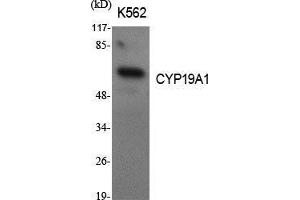 Western Blotting (WB) image for anti-Cytochrome P450, Family 19, Subfamily A, Polypeptide 1 (CYP19A1) (Internal Region) antibody (ABIN6281939)
