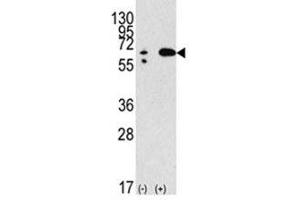 Western blot analysis of Beclin in 293 lysate transiently transfected with the BECN1 gene (2ug/lane). (Beclin 1 Antikörper  (AA 210-239))