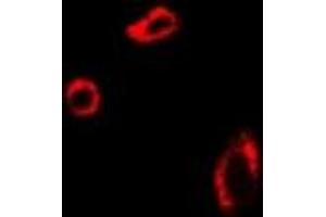 Immunofluorescent analysis of UROD staining in U2OS cells.