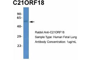 Host:  Rabbit  Target Name:  C21ORF18  Sample Type:  Human Fetal Lung  Antibody Dilution:  1. (SETD4 Antikörper  (C-Term))