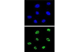 Confocal immunofluorescent analysis of p73 antibody with 293 cells followed by Alexa Fluor 488-conjugated goat anti-rabbit lgG (green).