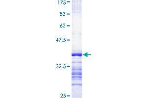 Obscurin Protein (OBSCN) (AA 6521-6620) (GST tag)