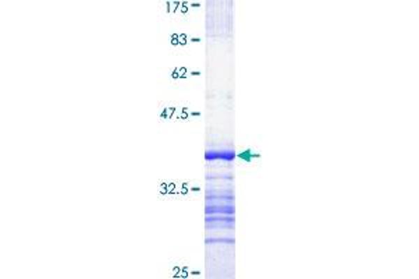 Obscurin Protein (OBSCN) (AA 6521-6620) (GST tag)