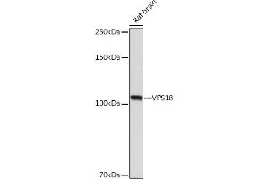 Western blot analysis of extracts of Rat brain, using VPS18 Rabbit mAb (ABIN7271274) at 1:1000 dilution. (VPS18 Antikörper)