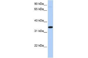 WB Suggested Anti-SLC44A3 Antibody Titration:  0. (SLC44A3 Antikörper  (Middle Region))