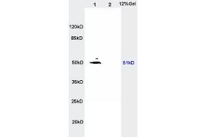 L1 rat kidney lysates, L2 rat brain lysates probed with Anti- SLC16A3/MCT4 Polyclonal Antibody, Unconjugated  at 1:200 in 4˚C. (SLC16A3 Antikörper  (AA 401-465))
